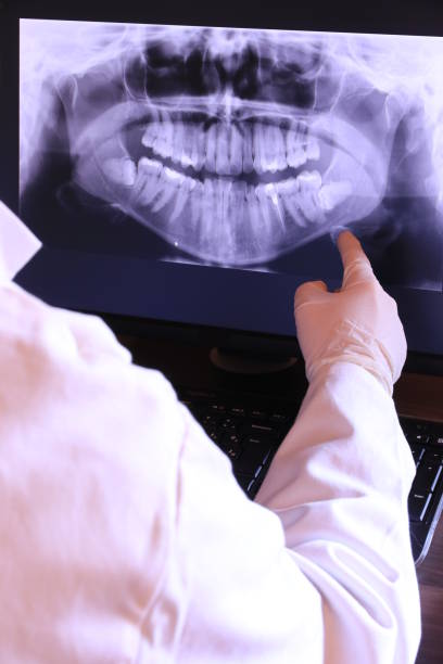 Best Emergency Dental Extractions in Stone Ridge, NY