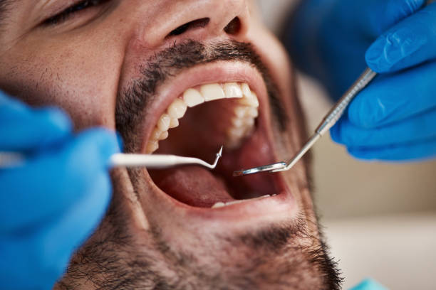 Best Emergency Dental Services for Seniors in Stone Ridge, NY