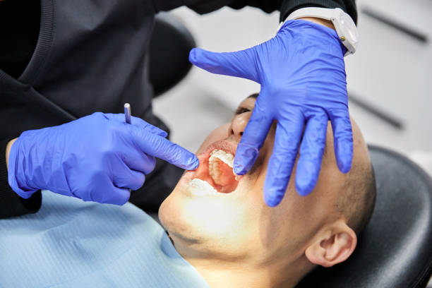 Best Broken or Cracked Tooth Emergency Dentist in Stone Ridge, NY